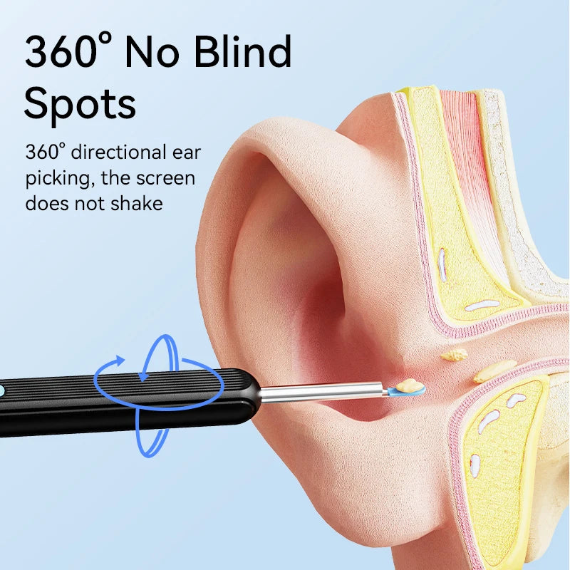 Ear Wax Removal Kit with Camera – 1296P HD Otoscope with 6 LED Lights and Wireless Endoscope for Safe Ear Cleaning