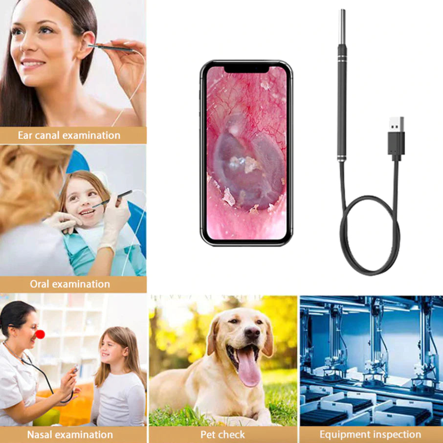 HD LED Ear Endoscope Otoscope Camera Wax Pick Cleaning Removal Kit