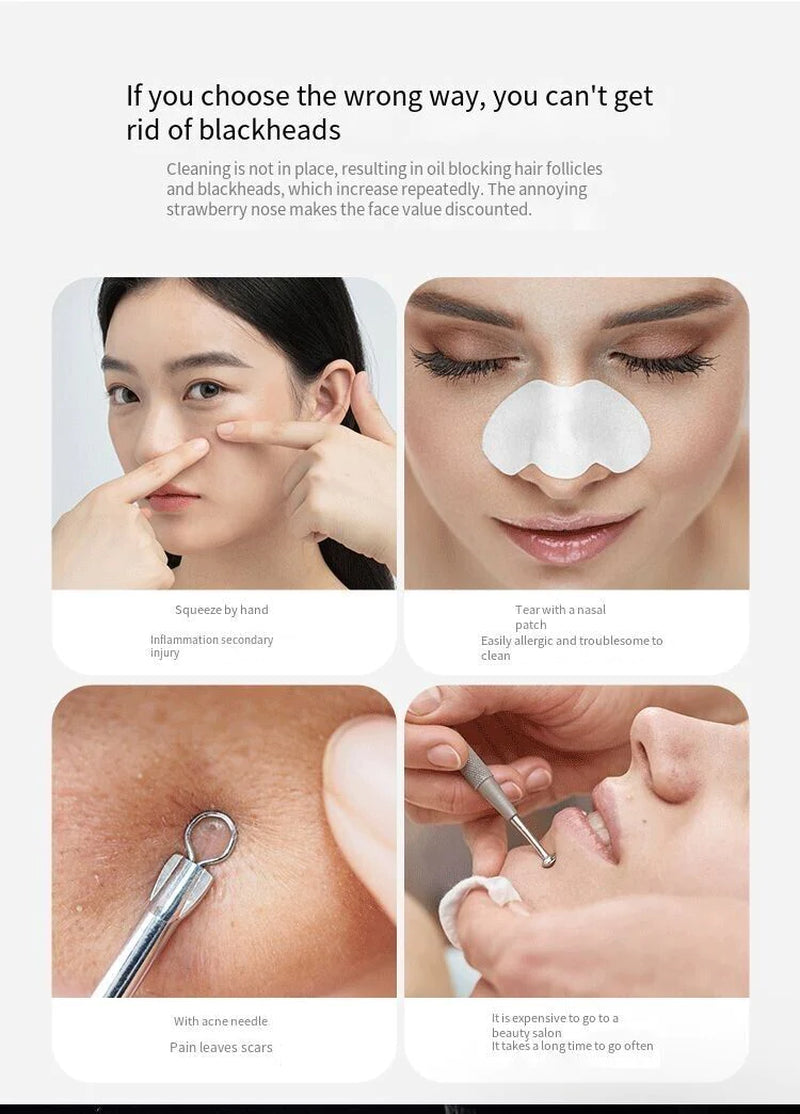 Electric Blackhead Remover Kit –Pore Vacuum Cleaner Kit with Adjustable Suction, Rechargeable Device & Interchangeable Heads for Face Skincare