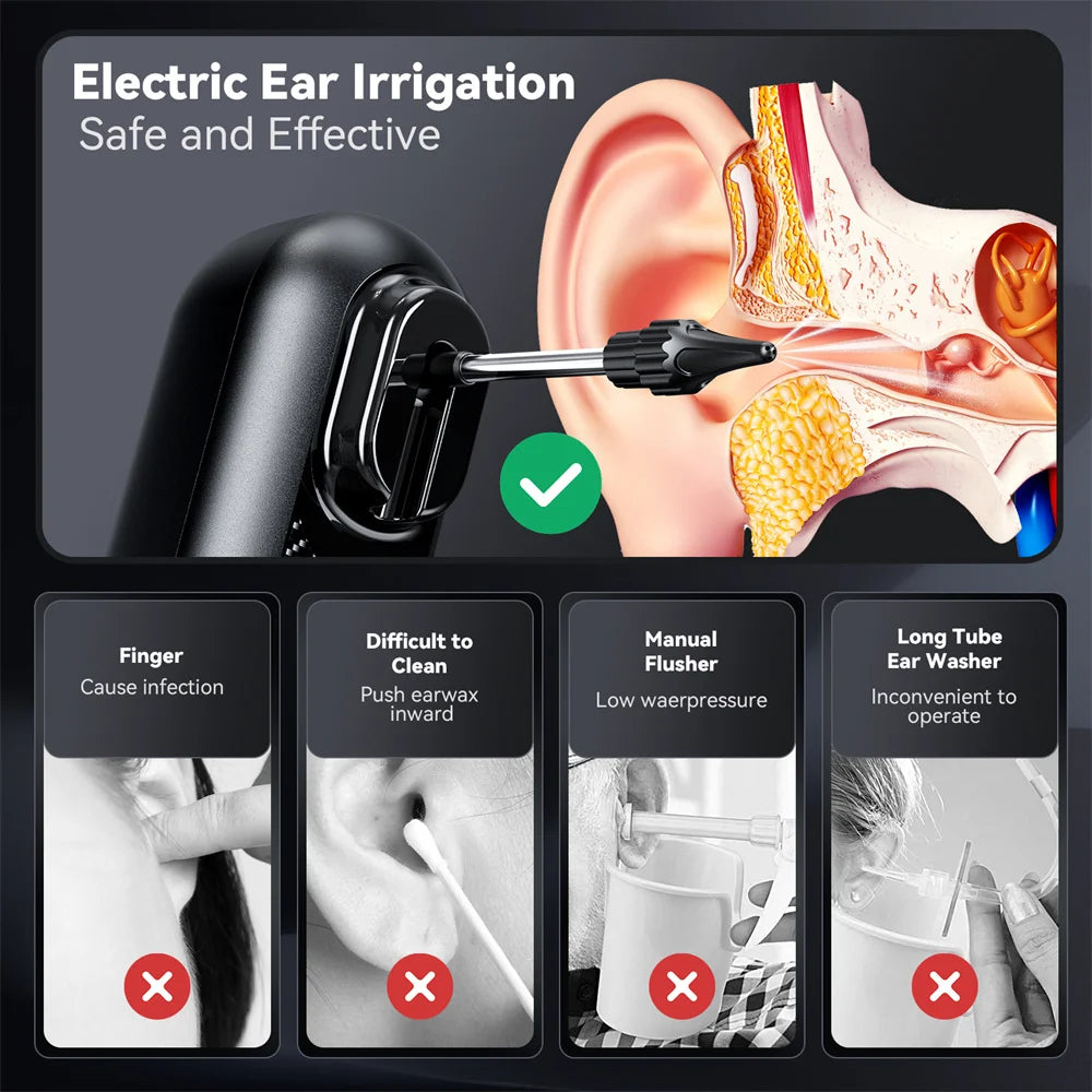 Electric Ear Wax Removal Kit – Water-Powered Ear Cleaning Tool with Irrigation Flusher, 10 Tips, and 4 Pressure Settings