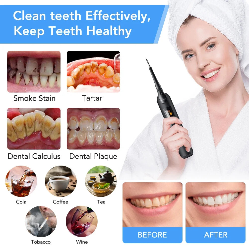 Ultrasonic Tooth Cleaner – Electric Plaque Remover with LED Display and Dental Tool Kit